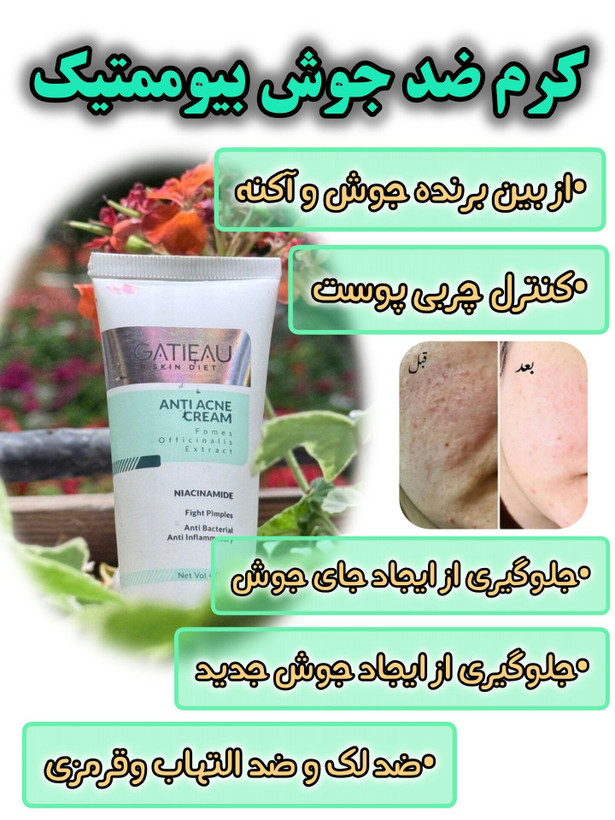 کرم بیوممتیک ضد جوش و ضدلک آنتی آکنه 40 میل گاتیو ایتالیا خرید اقساطی