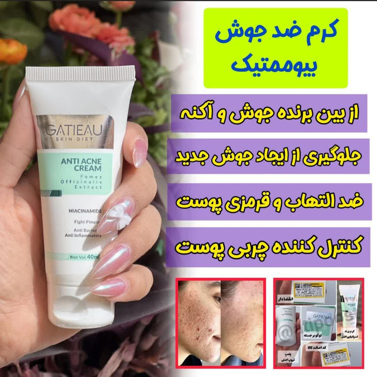 کرم بیوممتیک ضد لک 4 کاره گاتیو ایتالیا 40میل اصلی خرید اقساطی
