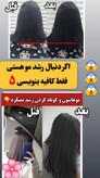 تونیک ضد ریزش و و رویش مجدد مو دوقلو برند اکسونیک-سوئیس خرید اقساطی