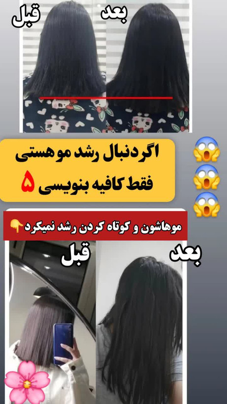 تونیک ضد ریزش و و رویش مجدد مو دوقلو برند اکسونیک-سوئیس خرید اقساطی