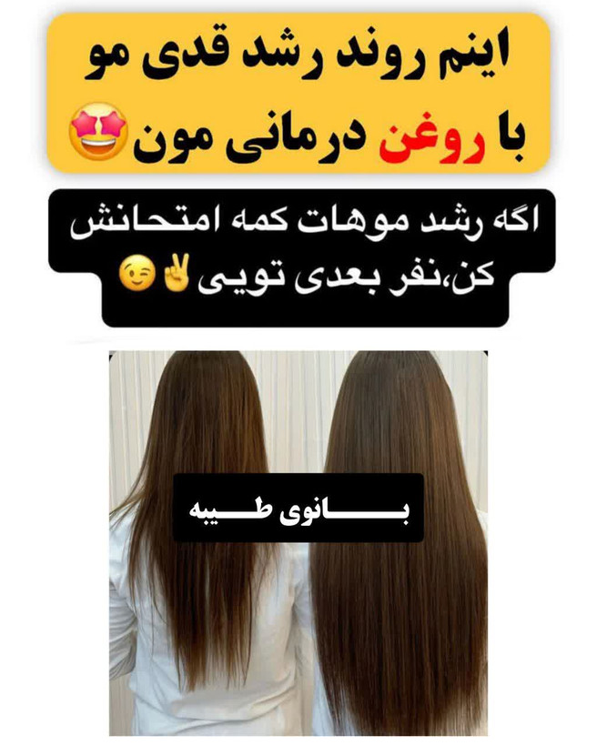 تونیک ضد ریزش و و رویش مجدد مو دوقلو برند اکسونیک-سوئیس خرید اقساطی