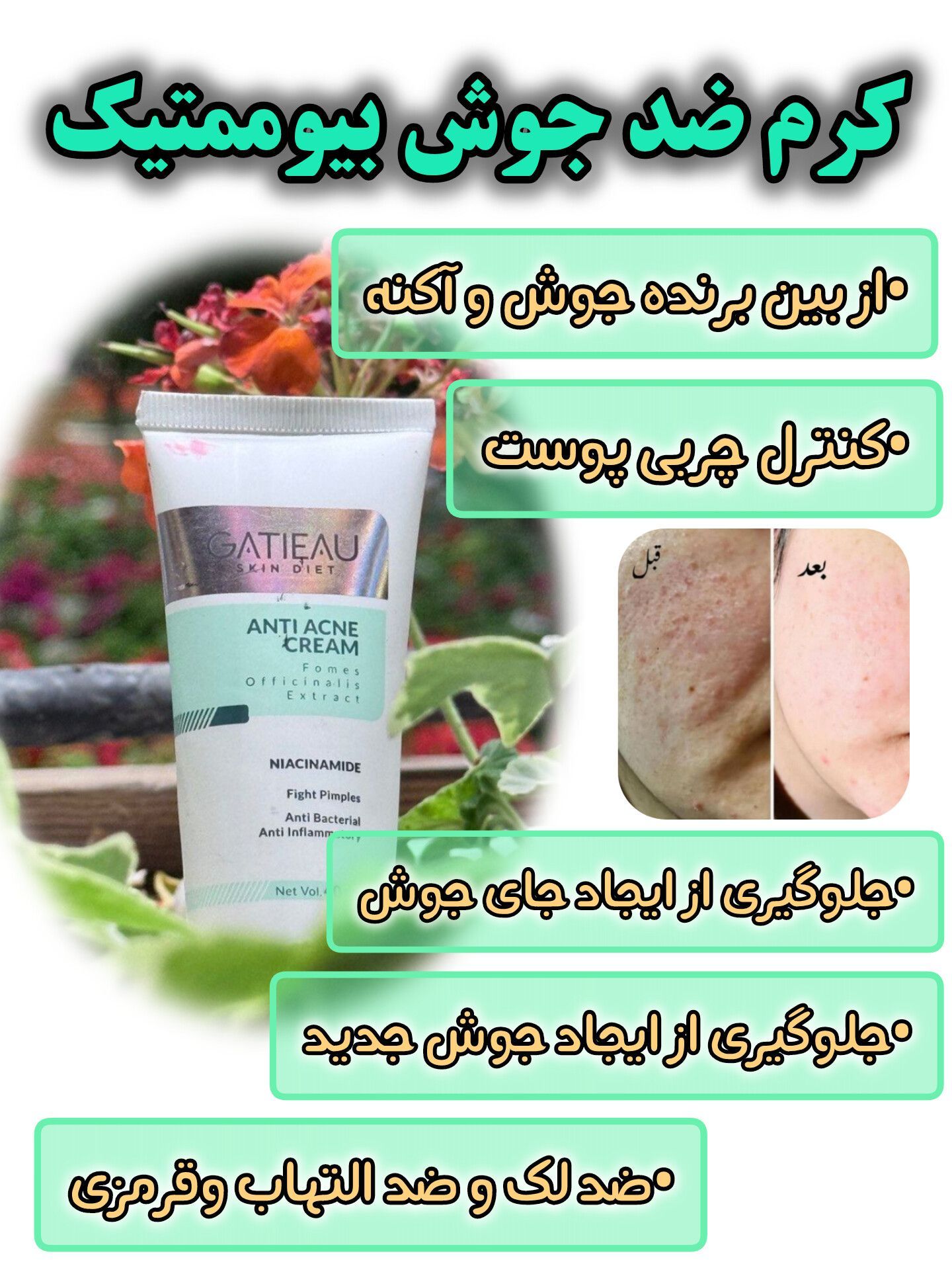 کرم بیوممتیک ضد جوش و ضدلک آنتی آکنه 40 میل گاتیو ایتالیا خرید اقساطی